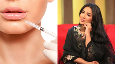 Mathira Mohammad Shares Insights Into Her Lip Filler Experience